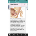 Intrauterine Insemination (Sperm Placement) - The Patient Guide
